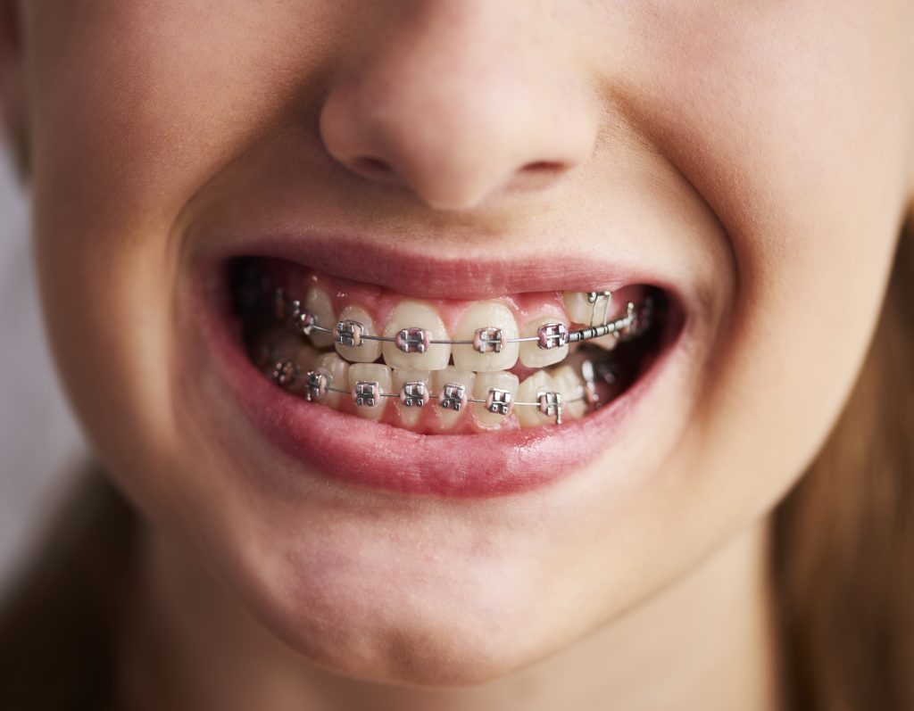 Muke sa fiksnom protezom: Šta jesti a šta ne, kako održavati higijenu i ublažiti bol